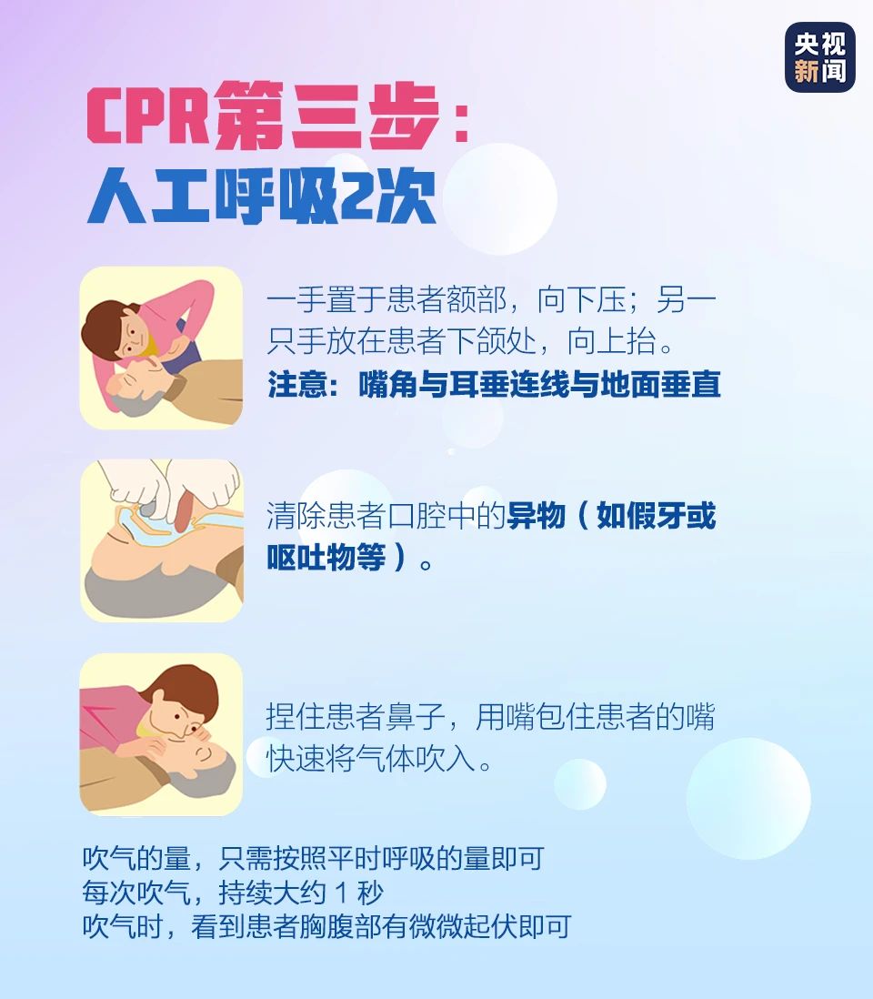 cpr法兰(cpr各指的是什么)